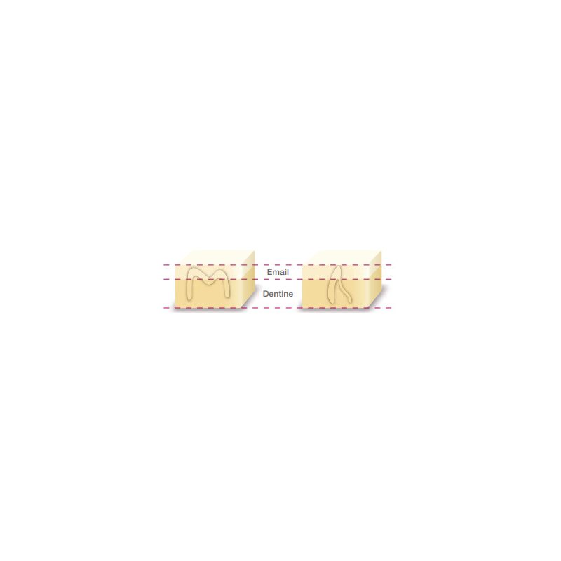 BLOCK HC CEREC M W2-LT x5